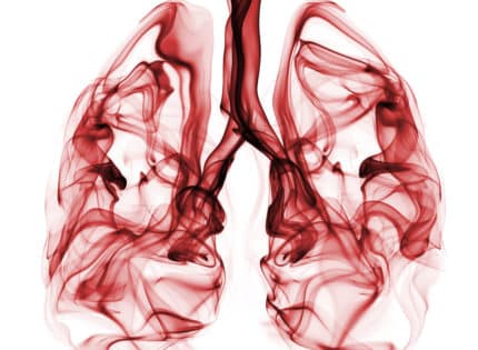 The Invisible Killer: Lung Cancer Revealed