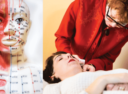 Acupuncture: Getting to the  Point of It