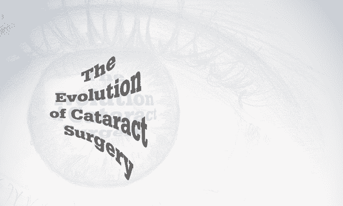 The Evolution of Cataract Surgery