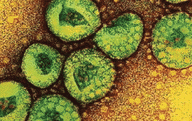 Middle East Respiratory Syndrome Coronavirus Makes First Appearance Stateside