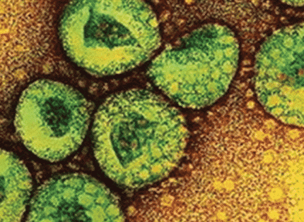 Middle East Respiratory Syndrome Coronavirus Makes First Appearance Stateside