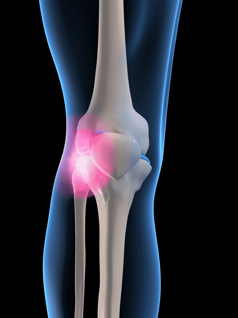 Noninvasive Procedure Alternative to Knee Replacement Surgery Chicago