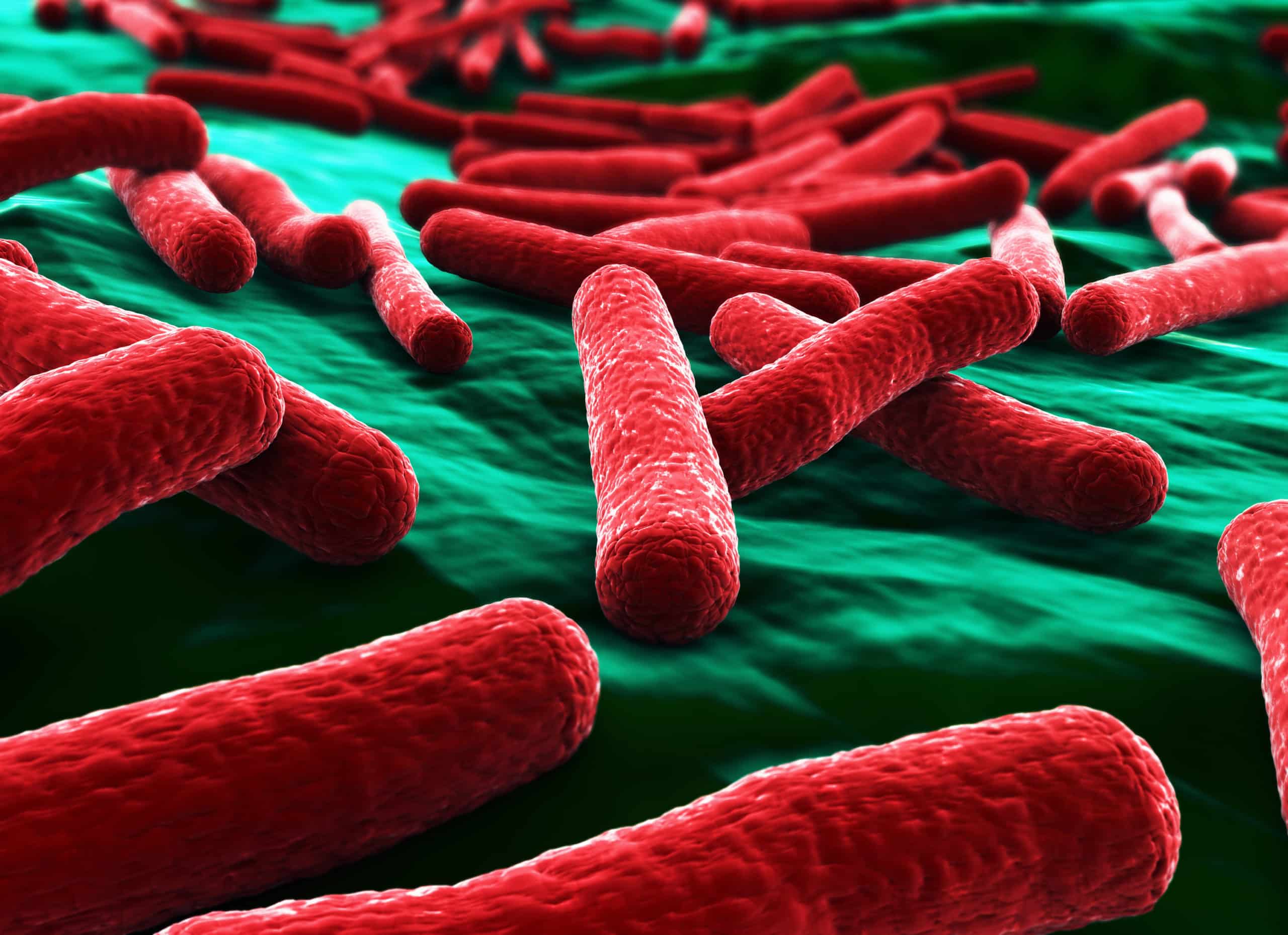 E. coli may hold one of the keys to treating Parkinson’s
