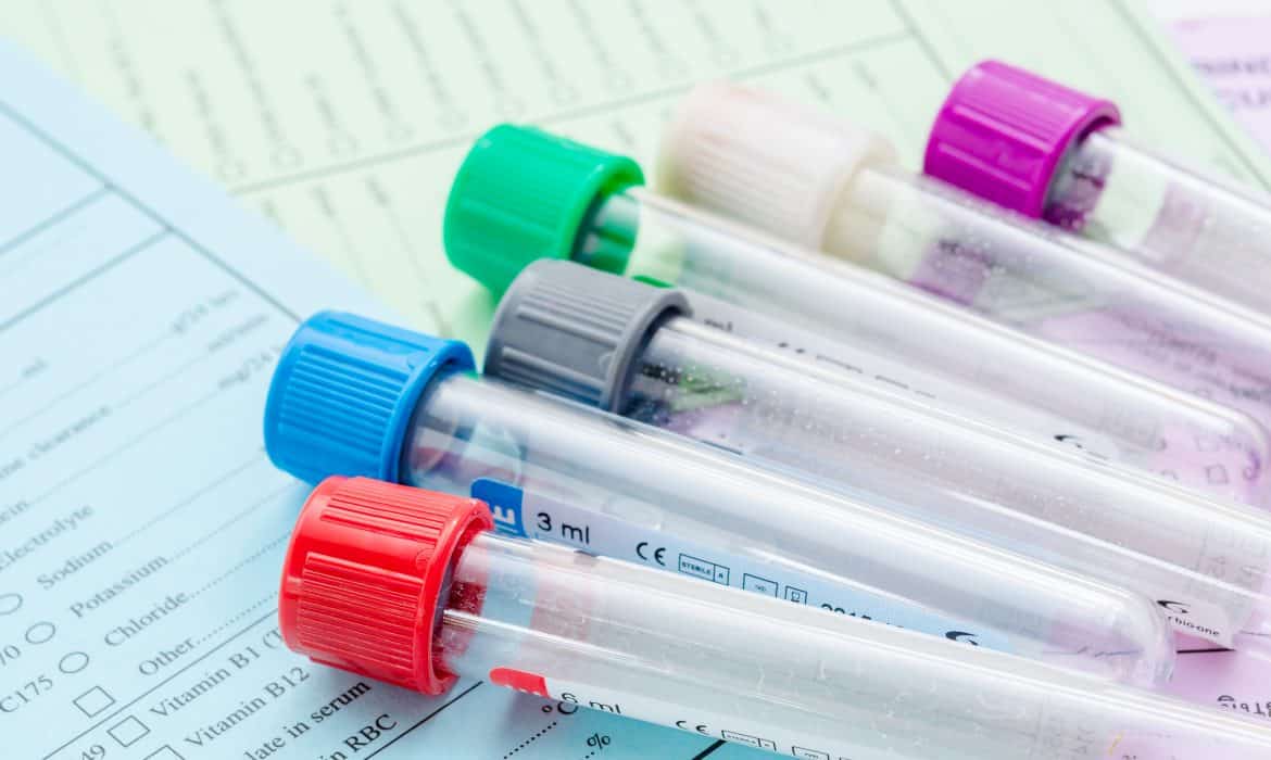 What you need to know about health screening tests