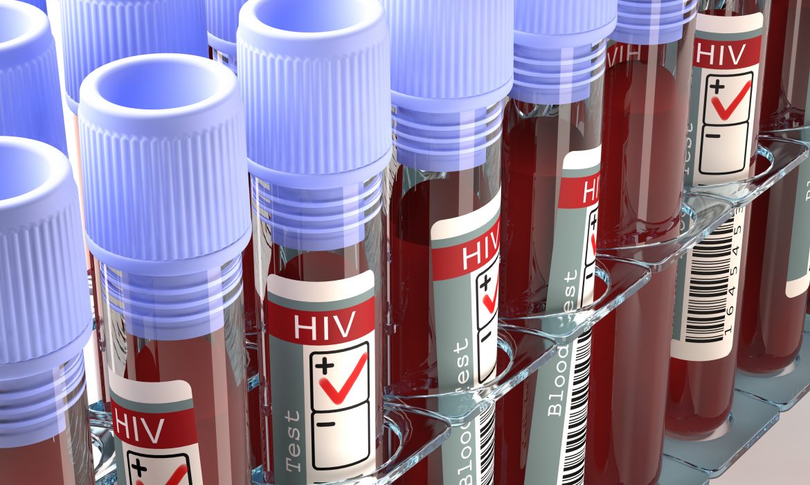 HIV still growing, even when undetectable in the blood