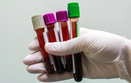 What To Do When Blood Test Results are Not Quite ‘Normal’