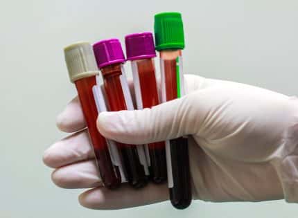 What To Do When Blood Test Results are Not Quite ‘Normal’