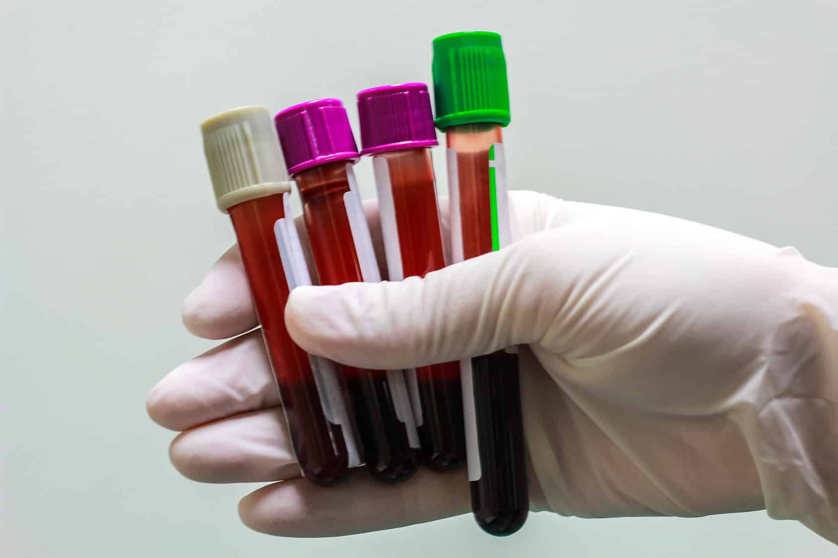 Are Abnormal Blood Test Results Normal