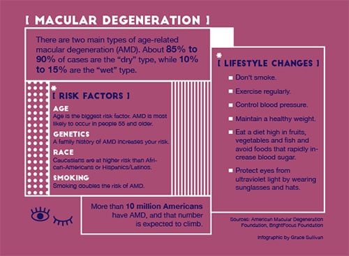 Mascular Degeneration infographic