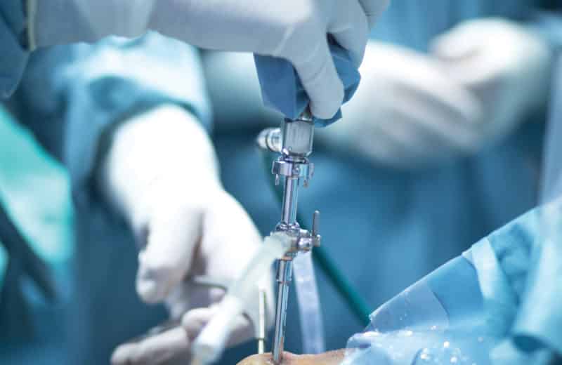 Orthopedic Surgery Scope