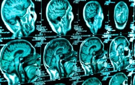 Low-carb diet slows progressive brain tumor