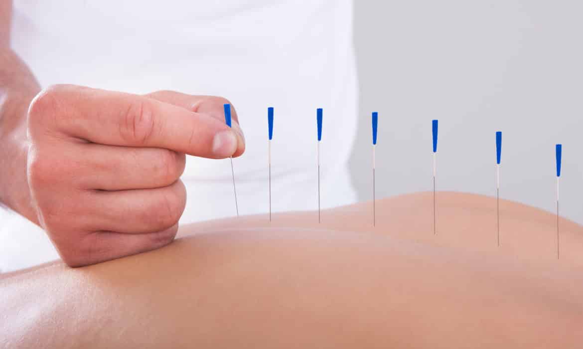 Acupuncture: A point in the right direction, or a stab in the dark?