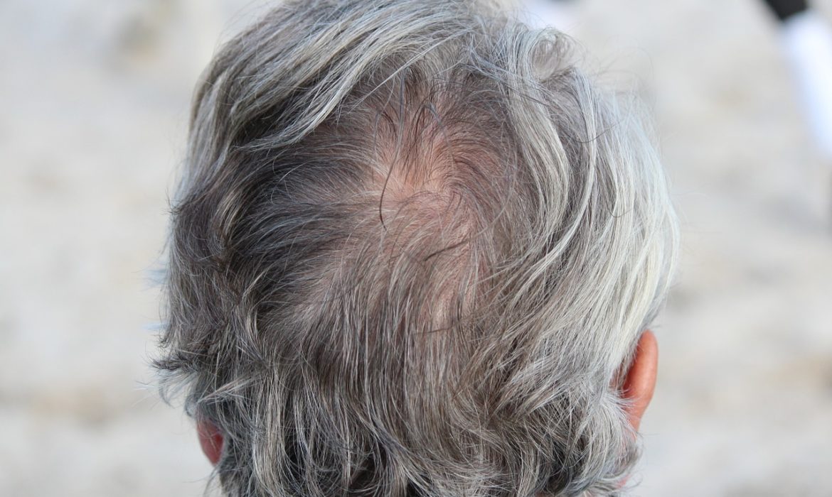 Why does hair turn gray?