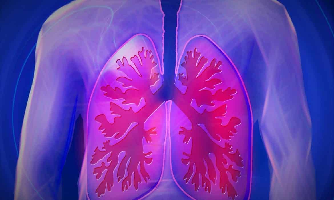 Cystic Fibrosis Often Identified Before Symptoms Start