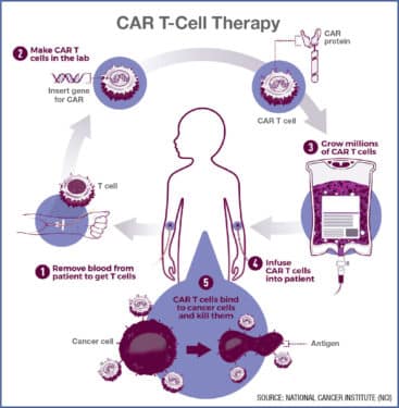 Car-T cell therapy infographic