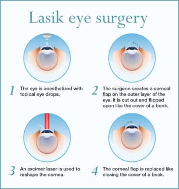 Eye Exam Orlando