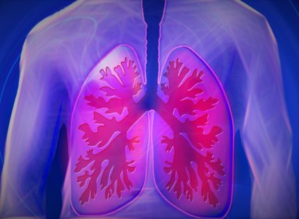 Mayo Clinic Q&A: Patients with Advanced Emphysema may Benefit from Lung Volume Reduction