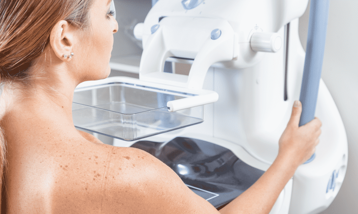 Molecular Breast Imaging for Dense Breasts