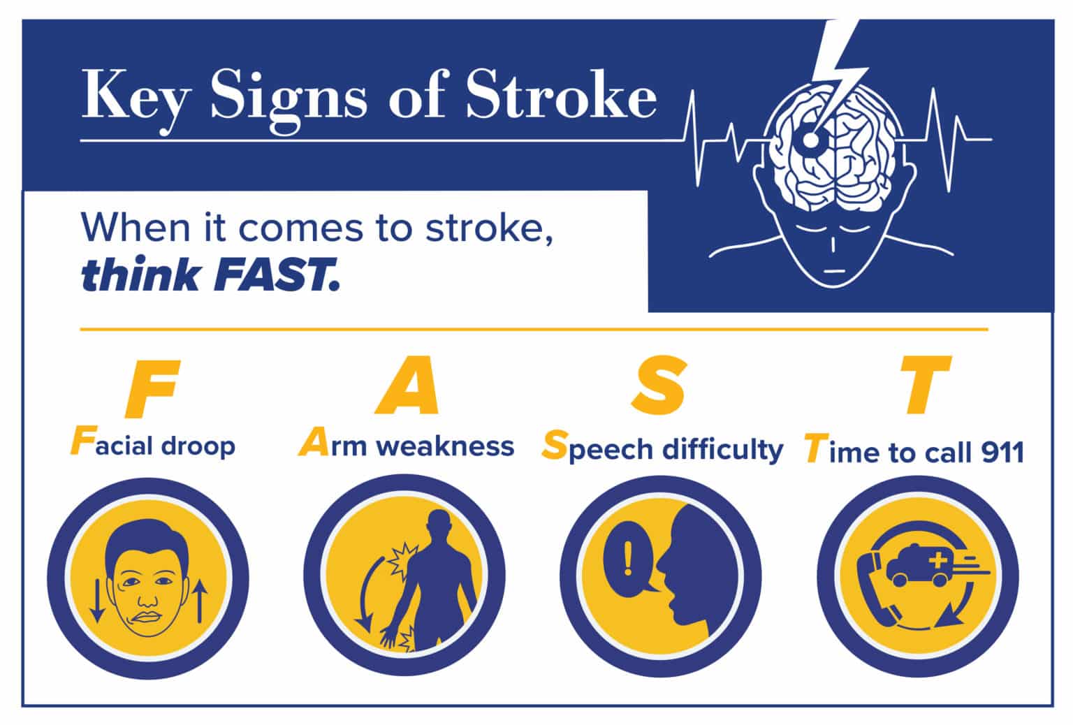 Time is Brain: When treating stroke, every minute counts