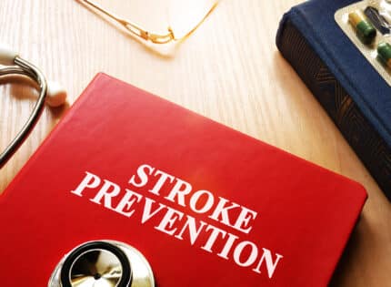 Mayo Clinic Q&A: 21st Century Stroke Prevention Strategies
