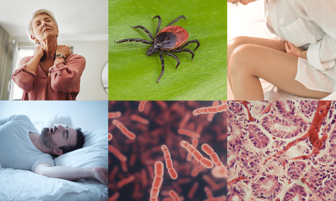6 Tough-to-Diagnose Diseases