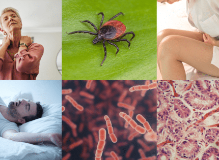 6 Tough-to-Diagnose Diseases