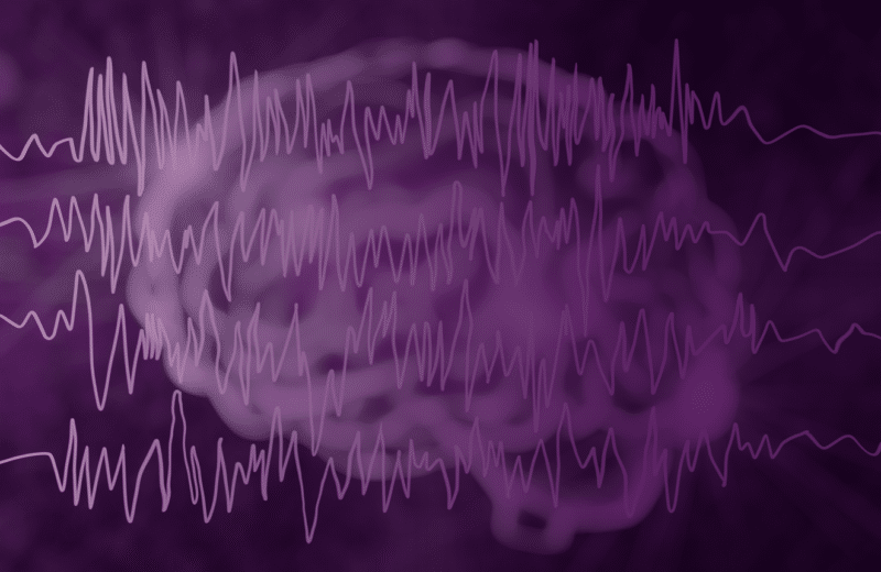 Brain image with waves representing epilepsy