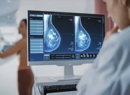 Risks Associated with Dense Breast Tissue