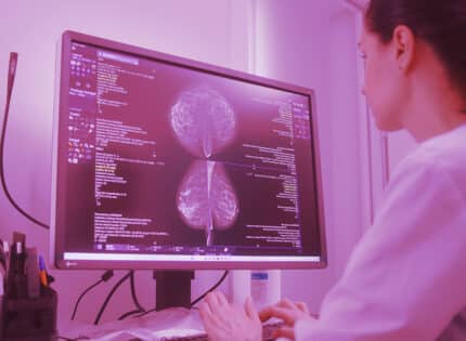 Diagnosing Breast Cancer with AI
