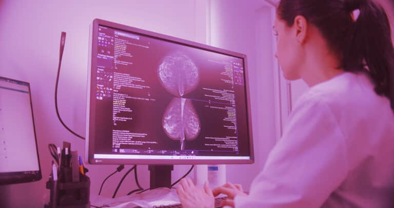 Diagnosing Breast Cancer with AI