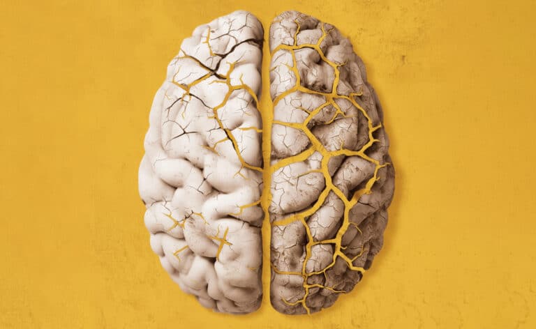 Representational illustration of an eroding brain representing Parkinson's Disease