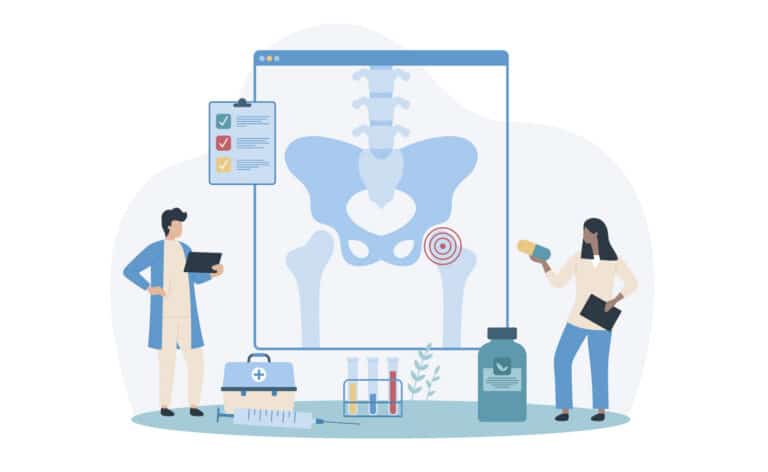 Illustration of doctors looking at an X-ray of a hip replacement hip socket.